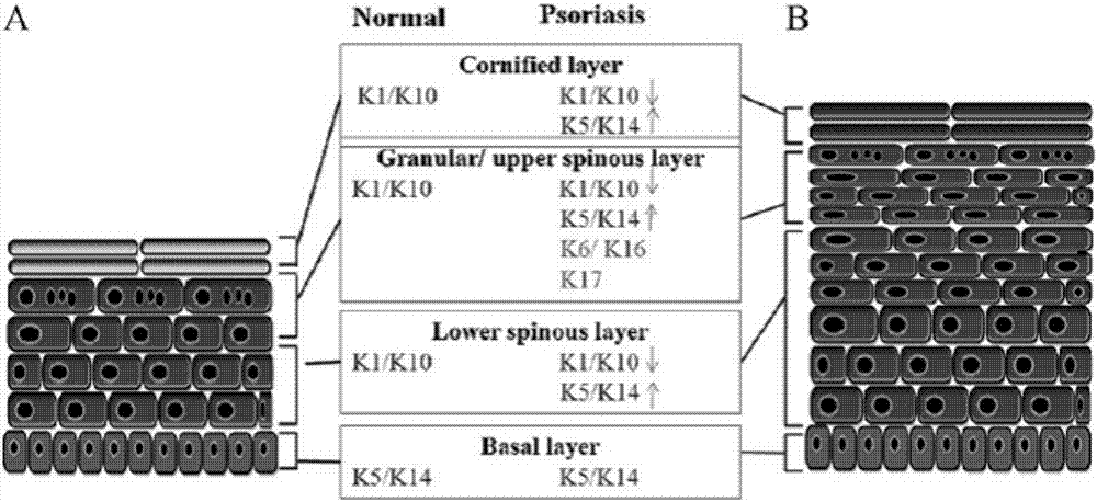 太阳成tyc7111cc-脑血管病成为南京人死亡第一杀手(图4) 太阳成集团tyc7111cc